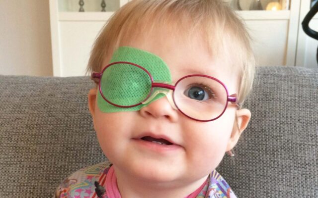 Baby med øjenplastre og briller. Reaktion øjenplaster.